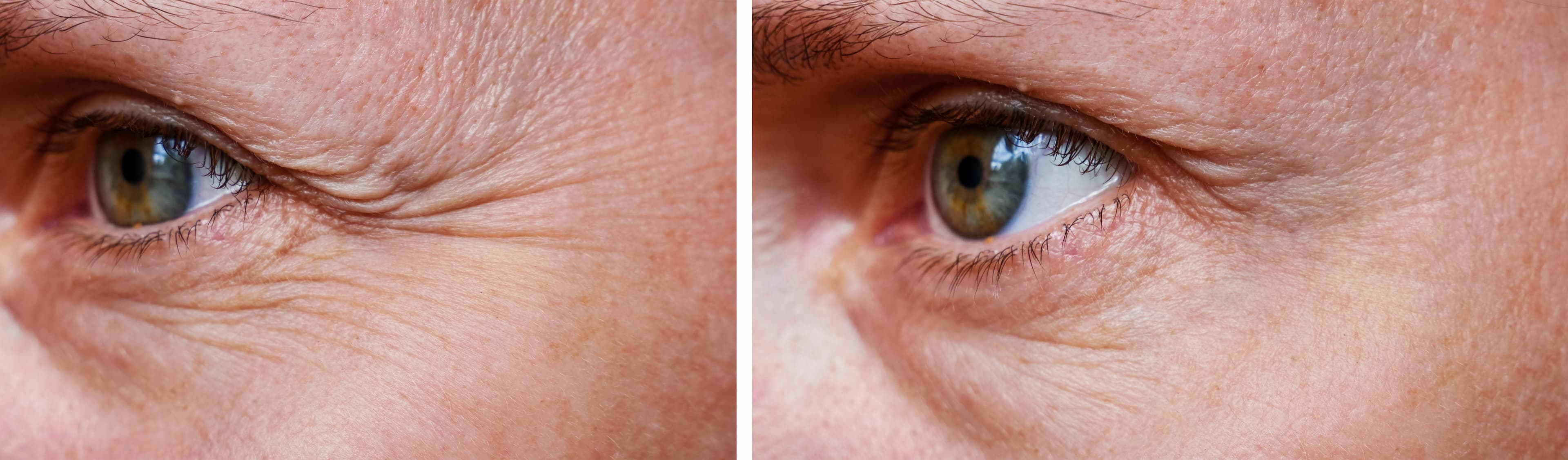 Before and After Clinical Results